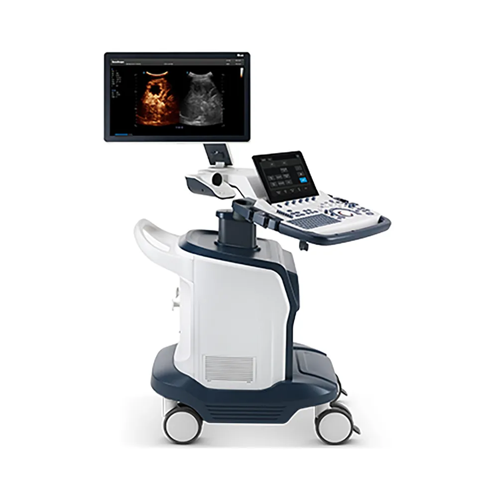 Ultrasound Scanner P60
