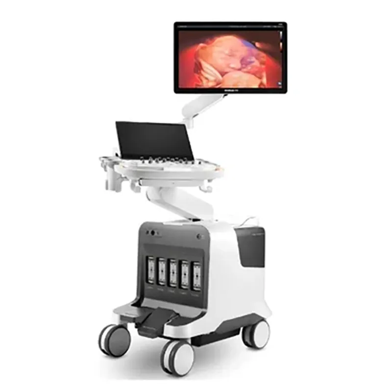 Ultrasound